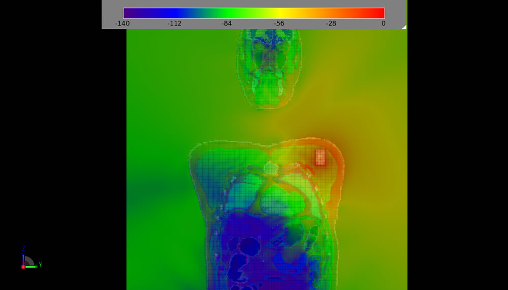  图 11：通过胸部的频域场幻灯片（人体渲染已打开）。